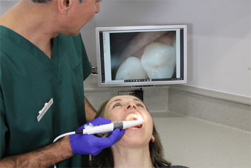 Intra Oral camera